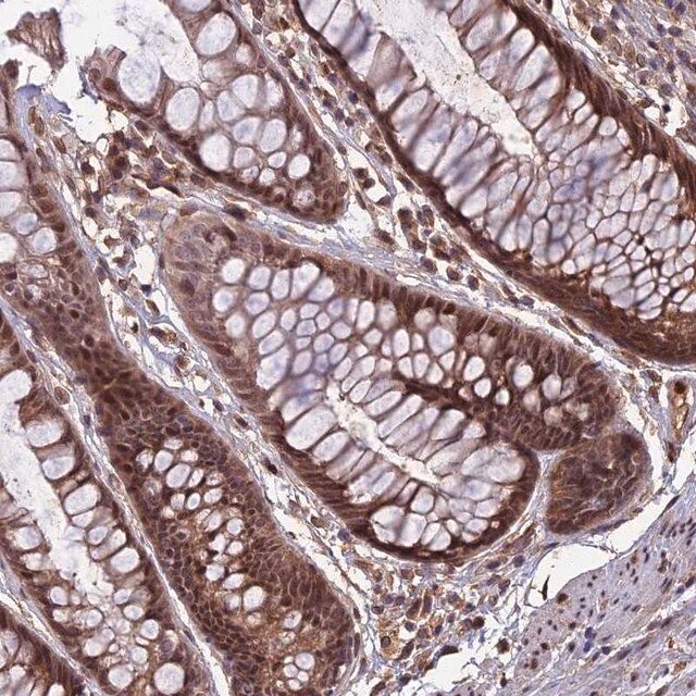 Anti-SPG11 antibody produced in rabbit