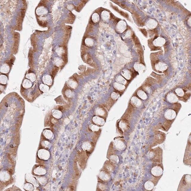 Anti-SPATS1 antibody produced in rabbit