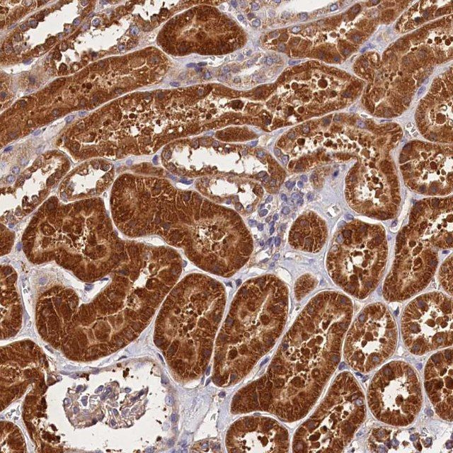 Anti-SPG11 antibody produced in rabbit