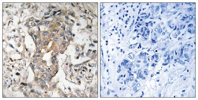 Anti-SPHK2 antibody produced in rabbit