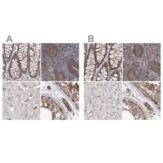 Anti-SPECC1 antibody produced in rabbit