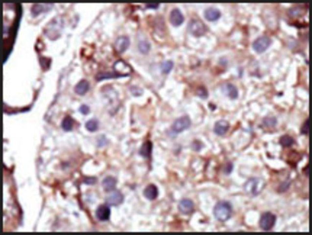 Anti-SPHK2 (N-term) antibody produced in rabbit