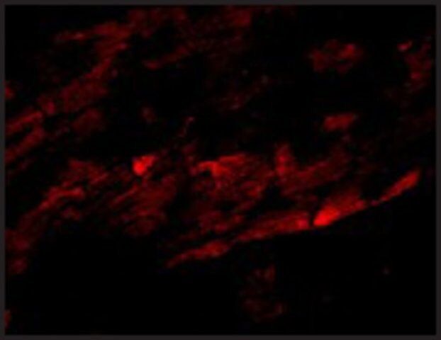 Anti-SPG15 antibody produced in rabbit