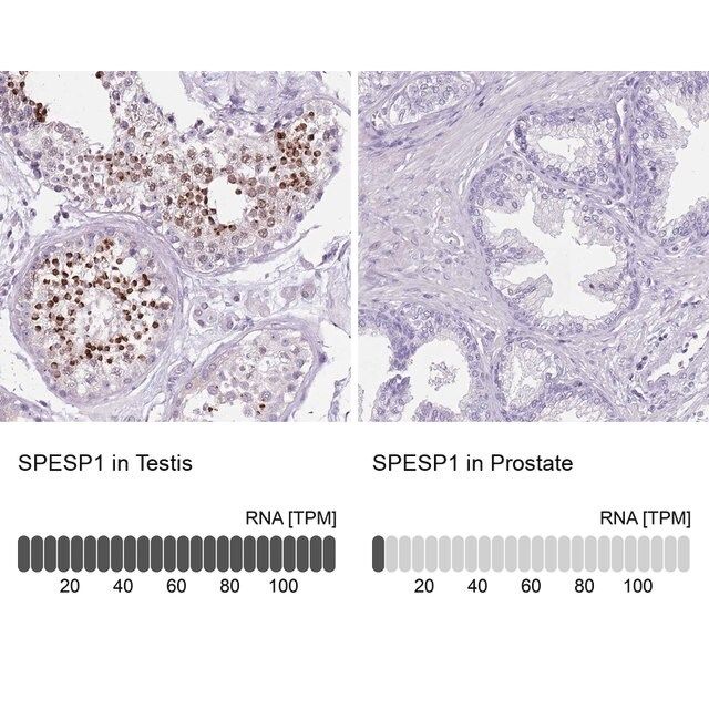 Anti-SPESP1 antibody produced in rabbit