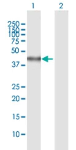 Anti-SPHK1 antibody produced in mouse