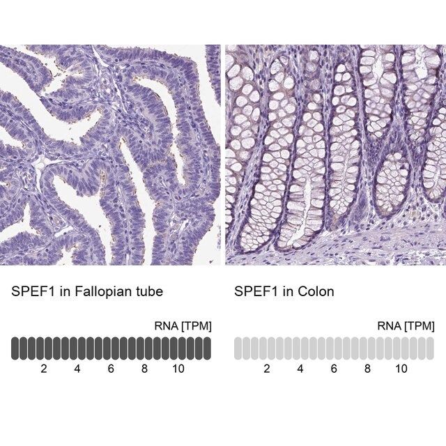 Anti-SPEF1 antibody produced in rabbit