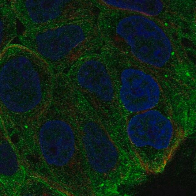 Anti-SPINT1 antibody produced in rabbit