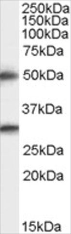 Anti-SPINESIN/TMPRSS5 antibody produced in goat