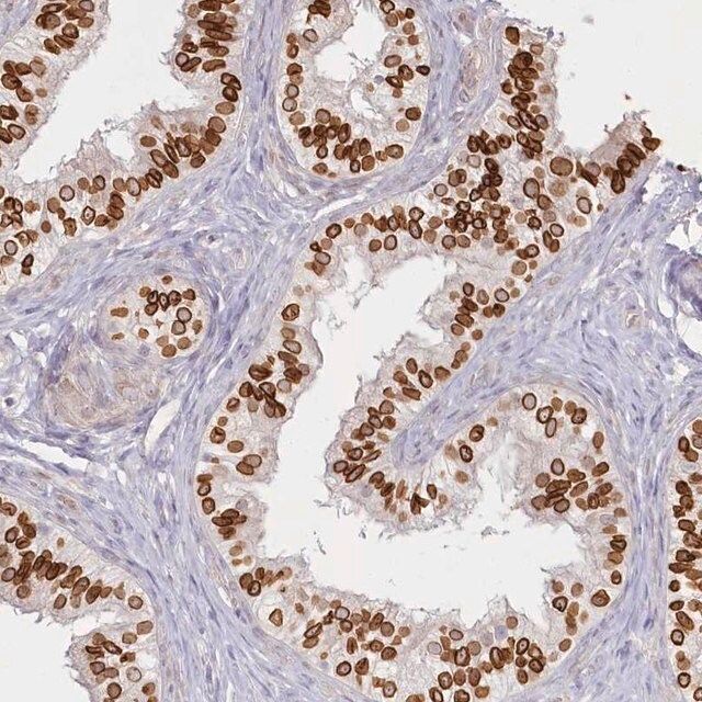 Anti-SPINK13 antibody produced in rabbit