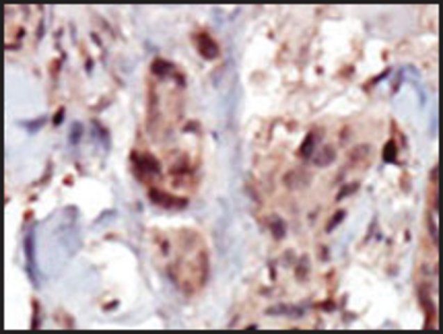 Anti-SPHK2 (C-term) antibody produced in rabbit