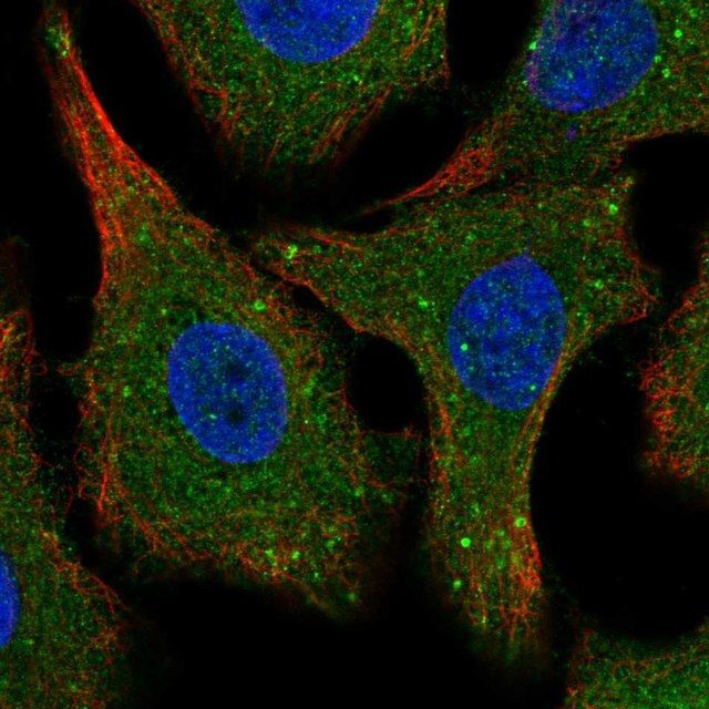 Anti-SPG21 antibody produced in rabbit