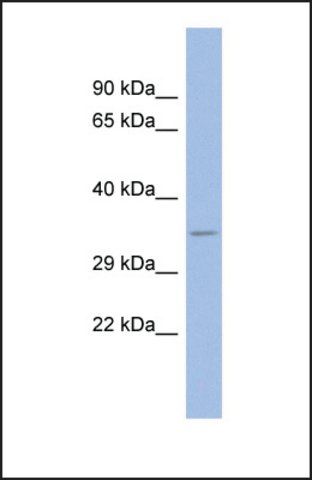 Anti-SPP1, (N-terminal) antibody produced in rabbit