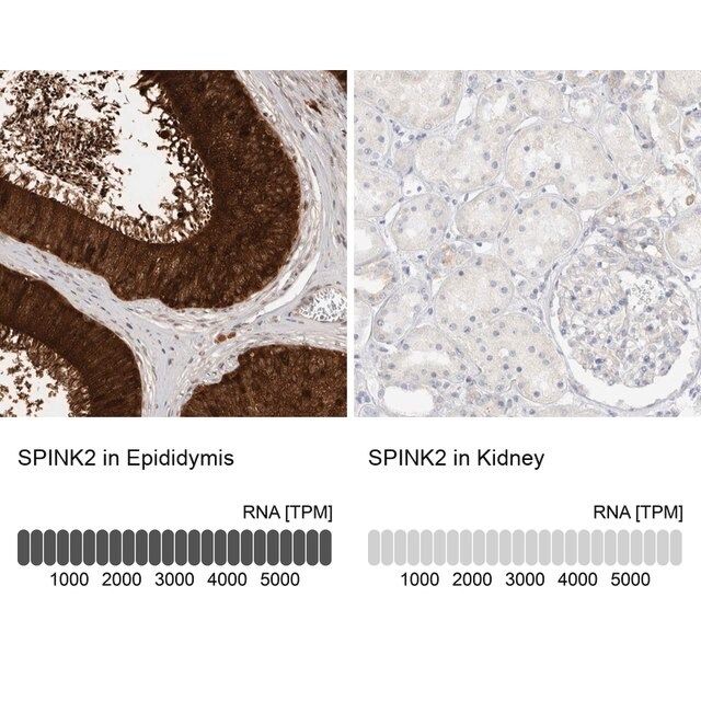 Anti-SPINK2 antibody produced in rabbit