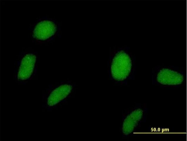 Anti-SPOP antibody produced in mouse