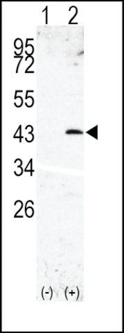 Anti-SPPL3 (N-term) antibody produced in rabbit