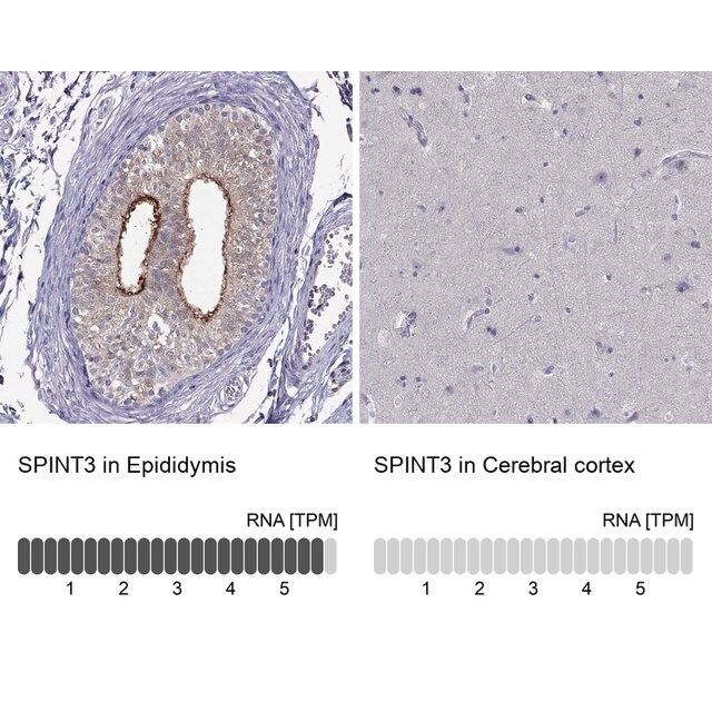 Anti-SPINT3