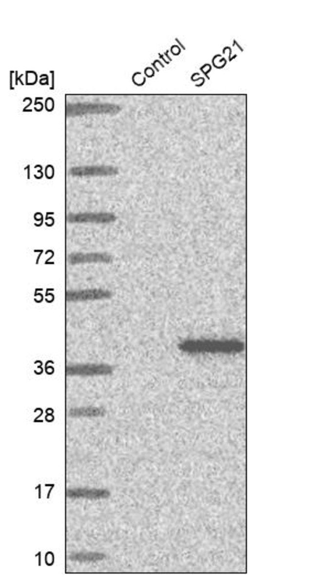 Anti-SPG21 antibody produced in rabbit