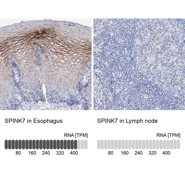 Anti-SPINK7 antibody produced in rabbit