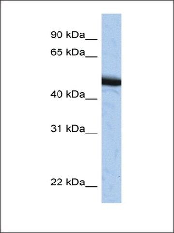 Anti-SPOP antibody produced in rabbit