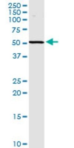 Anti-SPHK2 antibody produced in rabbit