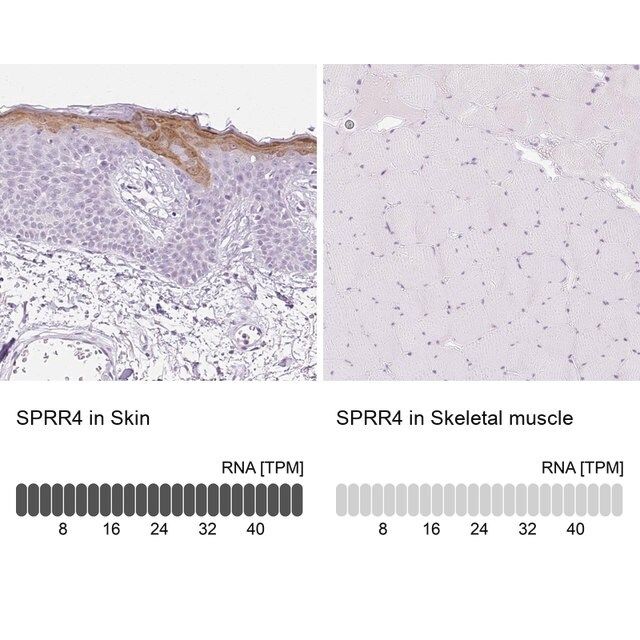 Anti-SPRR4 antibody produced in rabbit