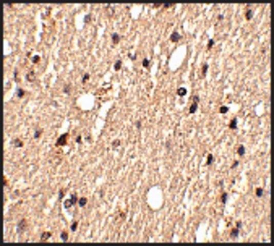 Anti-Spred1 (ab1) antibody produced in rabbit