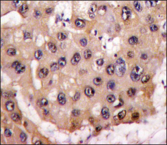 Anti-SPRED1 (C-term) antibody produced in rabbit