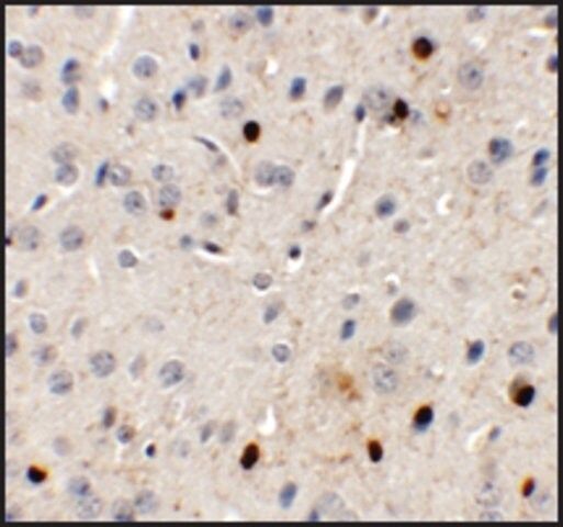 Anti-SPRYD3 antibody produced in rabbit