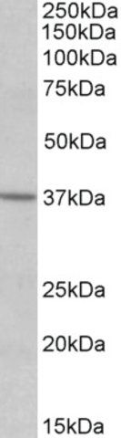 Anti-S1PR2 antibody produced in goat