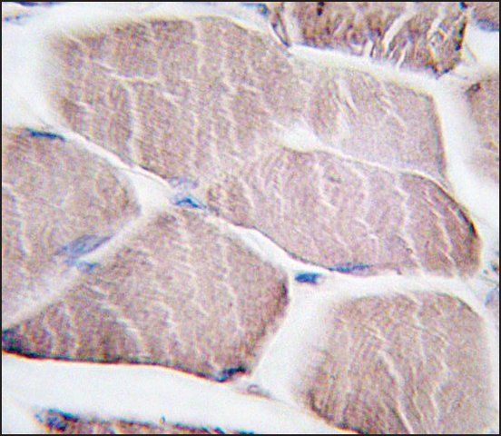 Anti-SPRED1 (N-term) antibody produced in rabbit