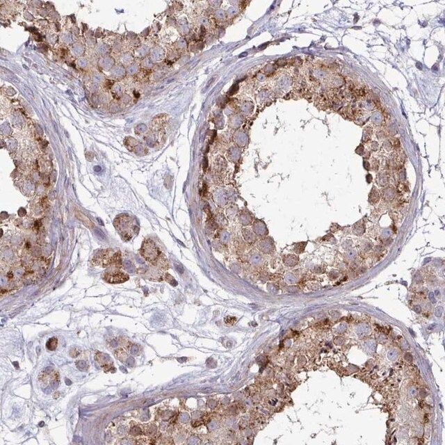 Anti-SPRY1 antibody produced in rabbit