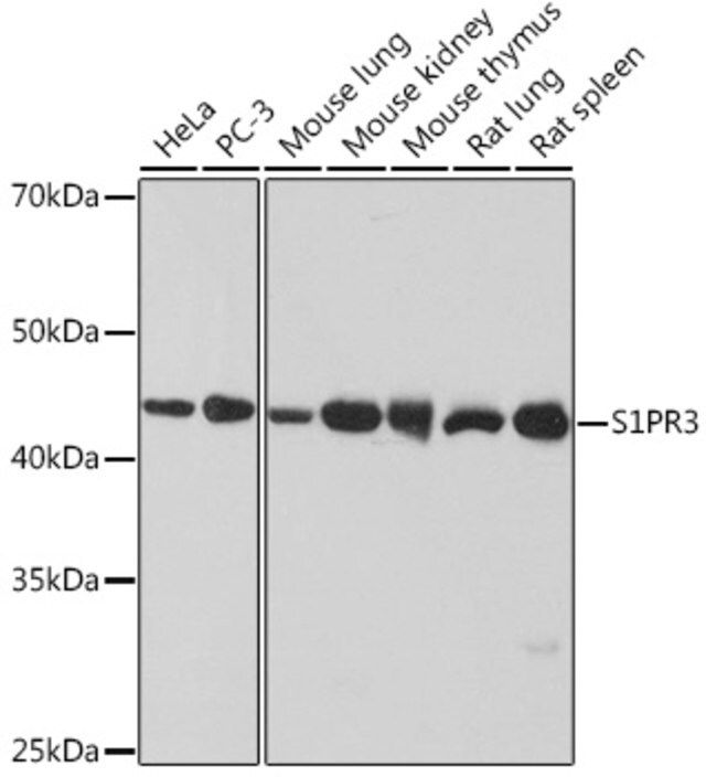 Anti-S1PR3 antibody produced in rabbit