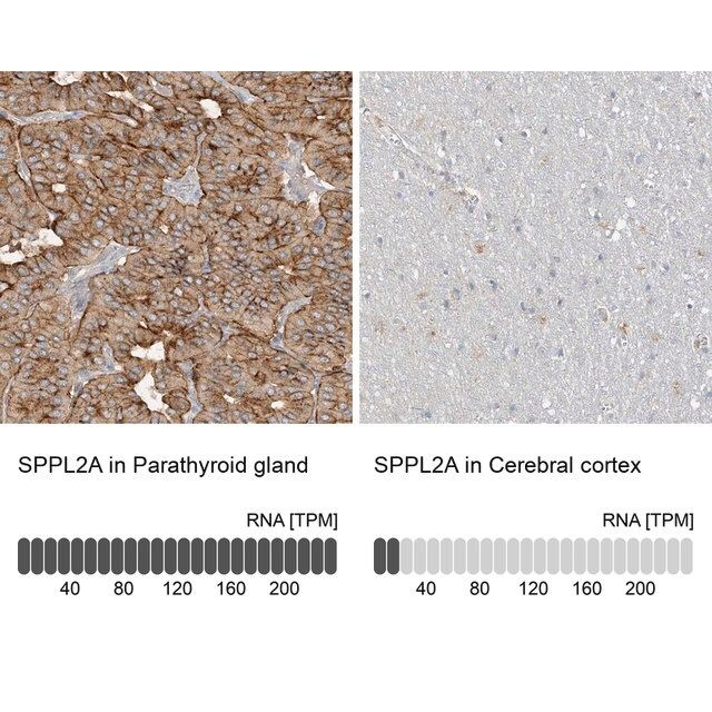 Anti-SPPL2A antibody produced in rabbit