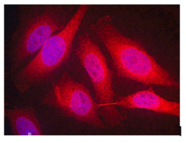 Anti-Spred-1 Antibody, clone M23-P2G3