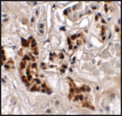 Anti-SPRYD4 antibody produced in rabbit