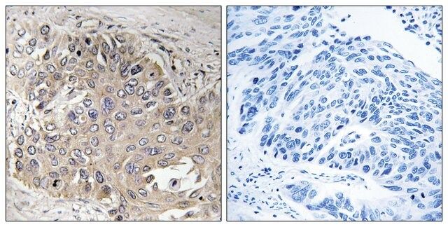 Anti-SPTBN5 antibody produced in rabbit