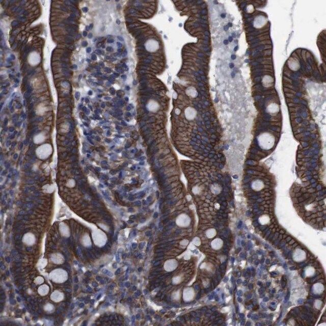 Anti-SPTBN1 antibody produced in rabbit