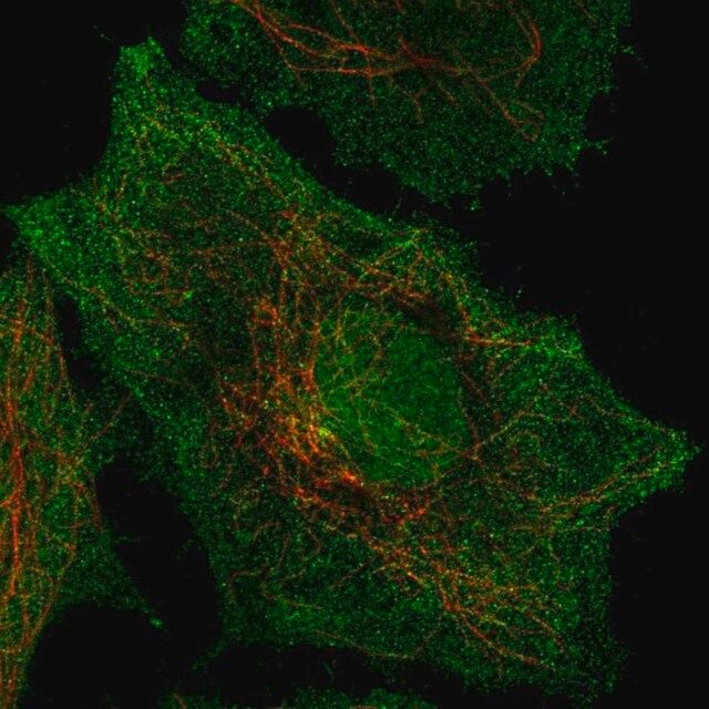 Anti-SPPL2B antibody produced in rabbit