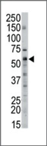 Anti-SPTLC2 (N-term) antibody produced in rabbit