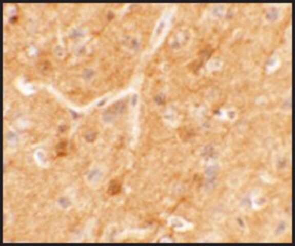 Anti-SPRYD5 antibody produced in rabbit