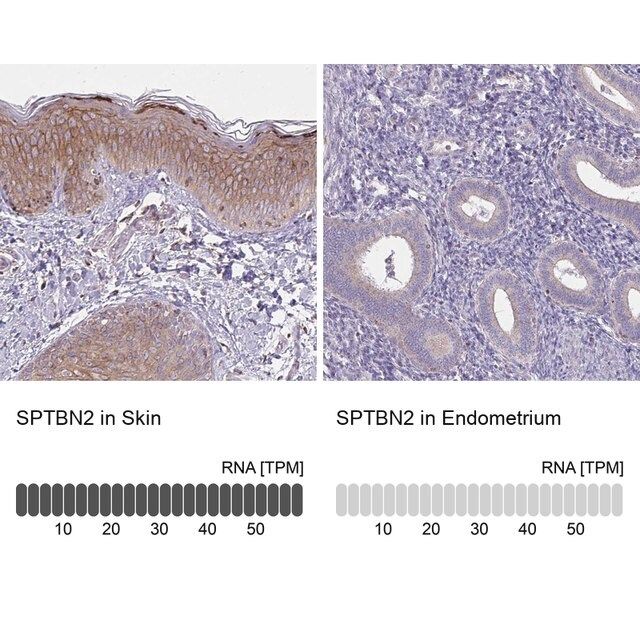 Anti-SPTBN2 antibody produced in rabbit