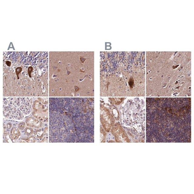 Anti-SPRYD3 antibody produced in rabbit