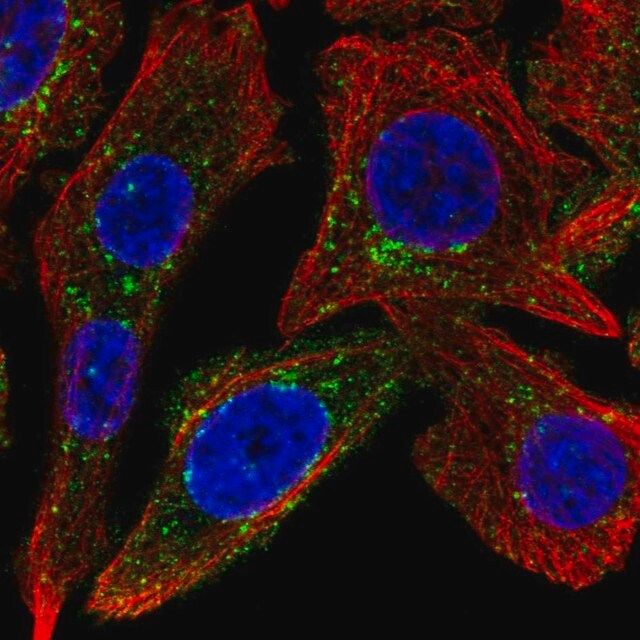 Anti-SPRY4 antibody produced in rabbit