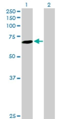 Anti-SLC27A6 antibody produced in mouse