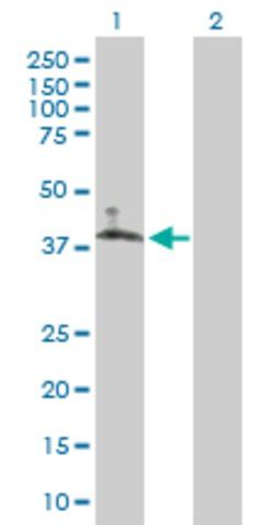 Anti-SLC10A6 antibody produced in mouse