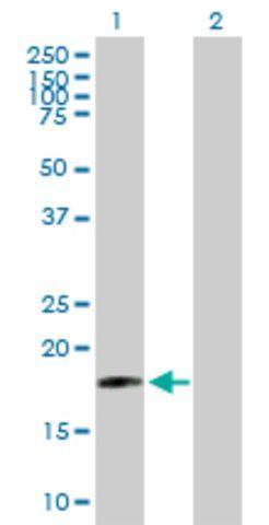 Anti-SIVA antibody produced in mouse