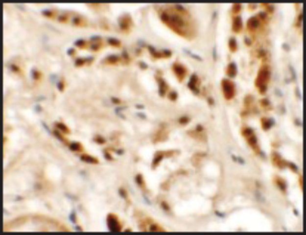 Anti-SIGLEC15 antibody produced in rabbit