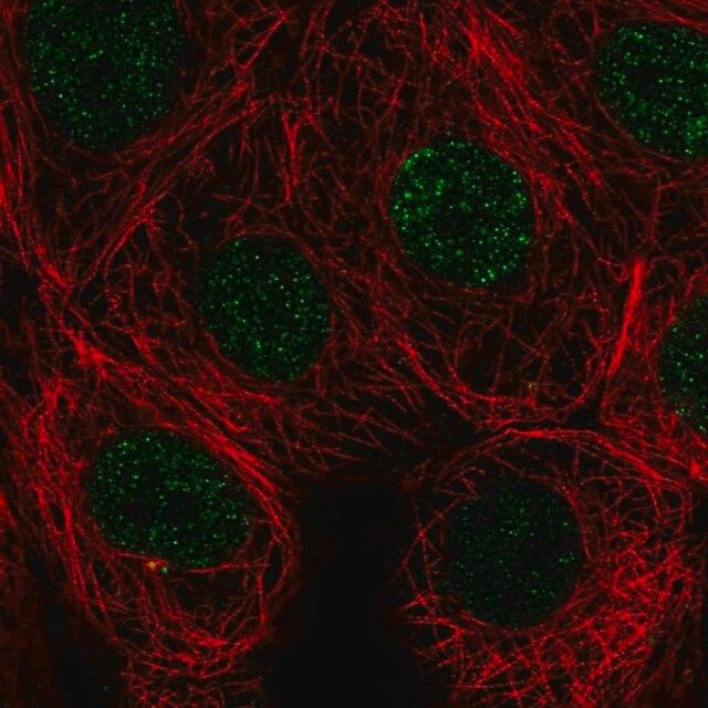 Anti-SIVA1 antibody produced in rabbit