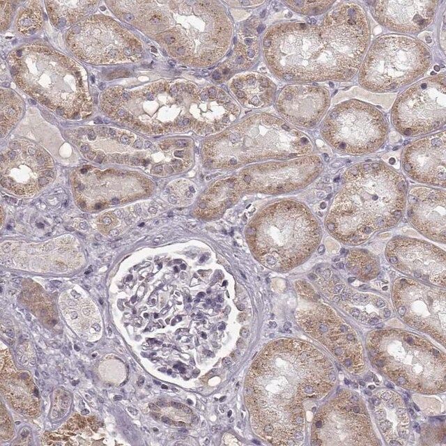 Anti-SLC4A5 antibody produced in rabbit