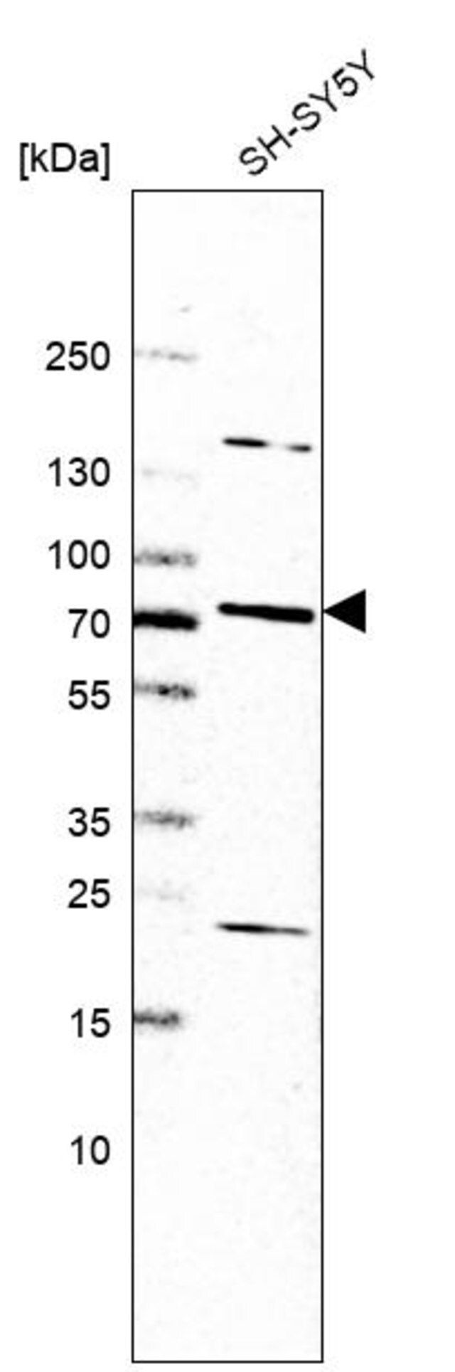 Anti-SLC44A5 antibody produced in rabbit